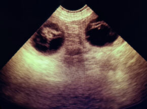 Canine Ultrasound