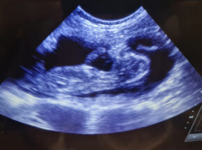 Cat Ultrasound