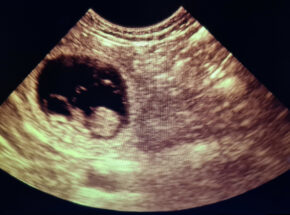 Dog Ultrasound