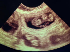 Feline Ultrasound